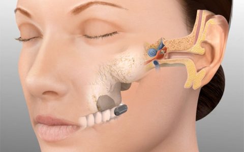 品音牙骨传导听力系统获上海市高新技术成果转化项目认定