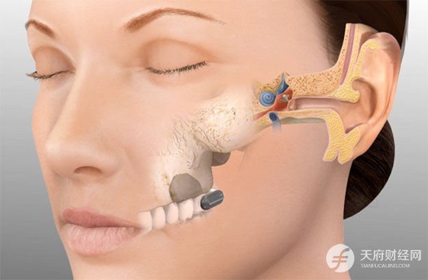 品音牙骨传导听力系统获上海市高新技术成果转化项目认定