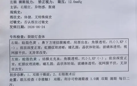 重视眼表炎症问题！成都东区爱尔首方开出新型抗炎药物利非司特，科学应对干眼困扰